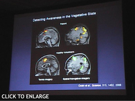Fmri_pvs_3_2